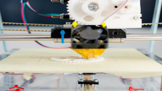 Doctors Implanted a 3D-Printed Vertebra for the First Time